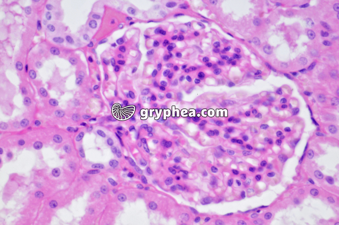 Glomérule Rein Singe x160 - gryphea.com